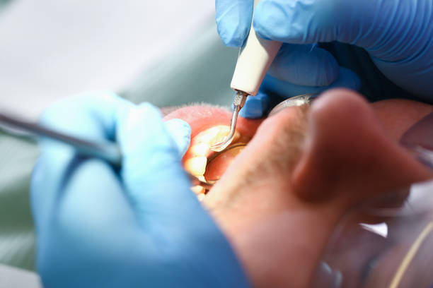 Best Pediatric Emergency Dentist in Arnaudville, LA