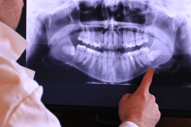Best Emergency Gum Treatment in Arnaudville, LA